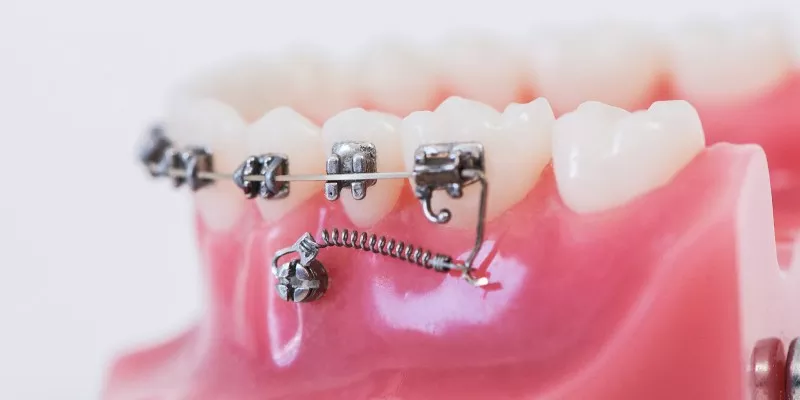 Orthodontie casa