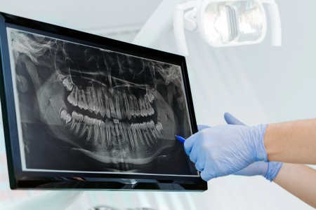 Radiologie dentaire