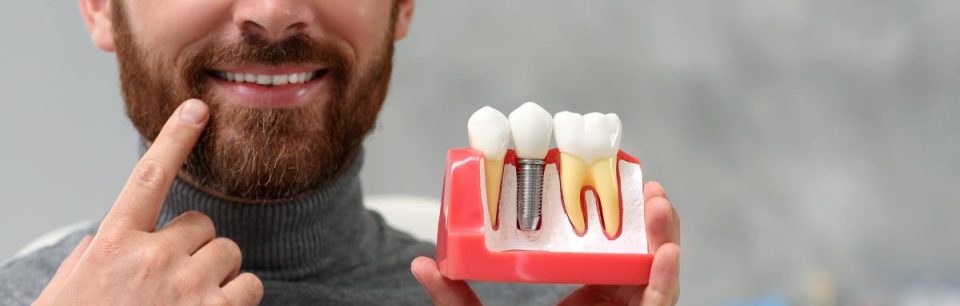 Implantologie dentaire